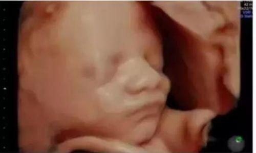 四维彩超有视频吗,捕捉胎儿成长瞬间